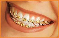 Sovereign Grade Black Moire Braces (Gold)